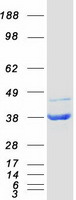 NUDT5 Protein - Purified recombinant protein NUDT5 was analyzed by SDS-PAGE gel and Coomassie Blue Staining