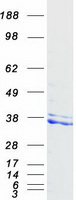 NUDT6 Protein - Purified recombinant protein NUDT6 was analyzed by SDS-PAGE gel and Coomassie Blue Staining