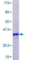 NUDT8 Protein - 12.5% SDS-PAGE of human NUDT8 stained with Coomassie Blue