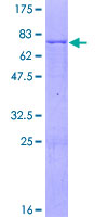 NUDT9 Protein - 12.5% SDS-PAGE of human NUDT9 stained with Coomassie Blue