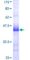 NUDT9 Protein - 12.5% SDS-PAGE Stained with Coomassie Blue.