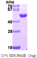 NUDT9 Protein