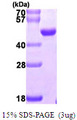 NUDT9 Protein