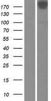 NUMA1 / NUMA Protein - Western validation with an anti-DDK antibody * L: Control HEK293 lysate R: Over-expression lysate
