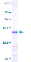 NUMB Protein - 12.5% SDS-PAGE of human NUMB stained with Coomassie Blue
