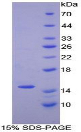 NUMB Protein - Recombinant Numb Homolog By SDS-PAGE