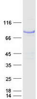 NUMB Protein - Purified recombinant protein NUMB was analyzed by SDS-PAGE gel and Coomassie Blue Staining