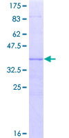 NUP153 Protein - 12.5% SDS-PAGE Stained with Coomassie Blue.