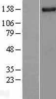 NUP155 Protein - Western validation with an anti-DDK antibody * L: Control HEK293 lysate R: Over-expression lysate
