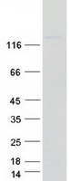 NUP155 Protein - Purified recombinant protein NUP155 was analyzed by SDS-PAGE gel and Coomassie Blue Staining