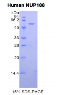 NUP188 Protein - Recombinant Nucleoporin 188kDa By SDS-PAGE