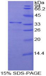 NUP205 Protein - Recombinant Nucleoporin 205kDa By SDS-PAGE