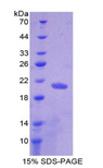 NUP210 / gp210 Protein - Recombinant Nucleoporin 210kDa By SDS-PAGE