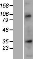 NUP35 / NUP53 Protein - Western validation with an anti-DDK antibody * L: Control HEK293 lysate R: Over-expression lysate