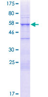 NUP35 / NUP53 Protein - 12.5% SDS-PAGE of human NUP35 stained with Coomassie Blue