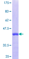 NUP35 / NUP53 Protein - 12.5% SDS-PAGE Stained with Coomassie Blue.