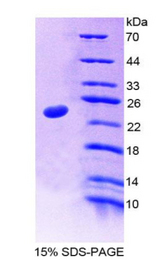 NUP35 / NUP53 Protein - Recombinant Nucleoporin 35kDa By SDS-PAGE