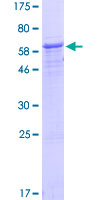 NUP37 Protein - 12.5% SDS-PAGE of human NUP37 stained with Coomassie Blue