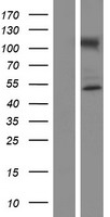 NUP50 Protein - Western validation with an anti-DDK antibody * L: Control HEK293 lysate R: Over-expression lysate