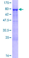 NUP50 Protein - 12.5% SDS-PAGE of human NUP50 stained with Coomassie Blue