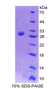 NUP50 Protein - Recombinant Nucleoporin 50kDa By SDS-PAGE