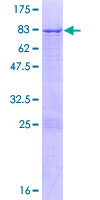 NUP54 Protein - 12.5% SDS-PAGE of human NUP54 stained with Coomassie Blue
