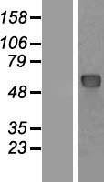 NUP62 Protein - Western validation with an anti-DDK antibody * L: Control HEK293 lysate R: Over-expression lysate