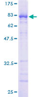 NUP62 Protein - 12.5% SDS-PAGE of human NUP62 stained with Coomassie Blue