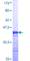 NUP62 Protein - 12.5% SDS-PAGE Stained with Coomassie Blue.