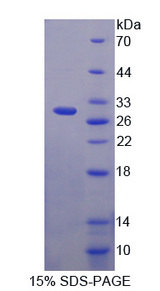 NUP62 Protein - Recombinant  Nucleoporin 62kDa By SDS-PAGE
