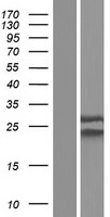 NUP62CL Protein - Western validation with an anti-DDK antibody * L: Control HEK293 lysate R: Over-expression lysate