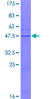 NUP62CL Protein - 12.5% SDS-PAGE of human RP13-383K5.2 stained with Coomassie Blue