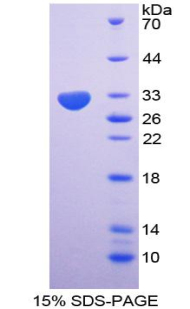 NUP85 / Pericentrin 1 Protein - Recombinant  Nucleoporin 85kDa By SDS-PAGE