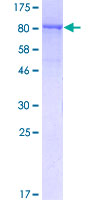 NUP98 Protein - 12.5% SDS-PAGE of human NUP98 stained with Coomassie Blue