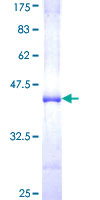NUP98 Protein - 12.5% SDS-PAGE Stained with Coomassie Blue.
