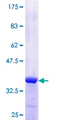 NUPL1 Protein - 12.5% SDS-PAGE Stained with Coomassie Blue.