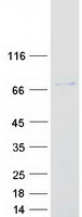 NUPL1 Protein - Purified recombinant protein NUP58 was analyzed by SDS-PAGE gel and Coomassie Blue Staining