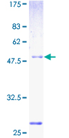 NUPL2 Protein - 12.5% SDS-PAGE of human NUPL2 stained with Coomassie Blue
