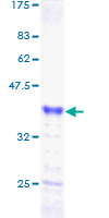 NUPR1 Protein - 12.5% SDS-PAGE of human P8 stained with Coomassie Blue