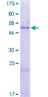 NUS1 Protein - 12.5% SDS-PAGE of human NUS1 stained with Coomassie Blue