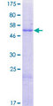 NUS1 Protein - 12.5% SDS-PAGE of human NUS1 stained with Coomassie Blue