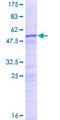 NUSAP1 / NUSAP Protein - 12.5% SDS-PAGE of human NUSAP1 stained with Coomassie Blue