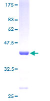 NUTF2 / PP15 Protein - 12.5% SDS-PAGE of human NUTF2 stained with Coomassie Blue
