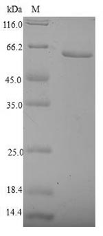 NUTF2 / PP15 Protein - (Tris-Glycine gel) Discontinuous SDS-PAGE (reduced) with 5% enrichment gel and 15% separation gel.