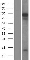 NUTM2F / FAM22F Protein - Western validation with an anti-DDK antibody * L: Control HEK293 lysate R: Over-expression lysate