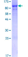 NVL Protein - 12.5% SDS-PAGE of human NVL stained with Coomassie Blue