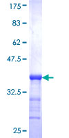 NVL Protein - 12.5% SDS-PAGE Stained with Coomassie Blue.