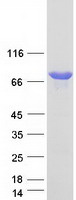 NVL Protein - Purified recombinant protein NVL was analyzed by SDS-PAGE gel and Coomassie Blue Staining