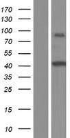 NXF1 / TAP Protein - Western validation with an anti-DDK antibody * L: Control HEK293 lysate R: Over-expression lysate