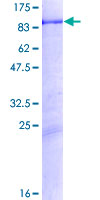 NXF1 / TAP Protein - 12.5% SDS-PAGE of human NXF1 stained with Coomassie Blue